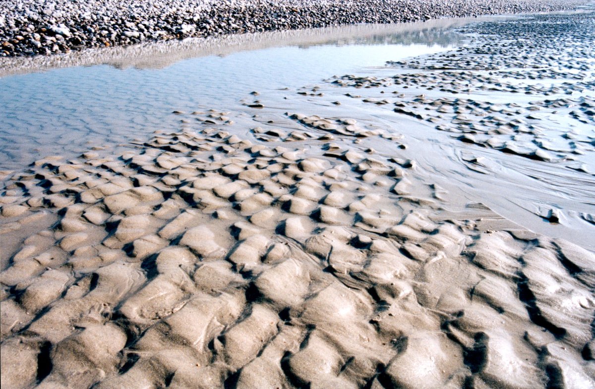 Chirurgie esthétique